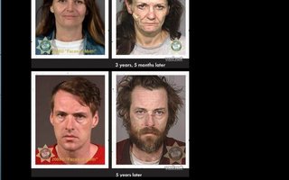 Faces Before and After Meth