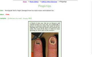 Karseiden sormien tarina | Tässä lyhyesti rumien sormien stoori